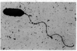 水稻白葉枯病的病原物